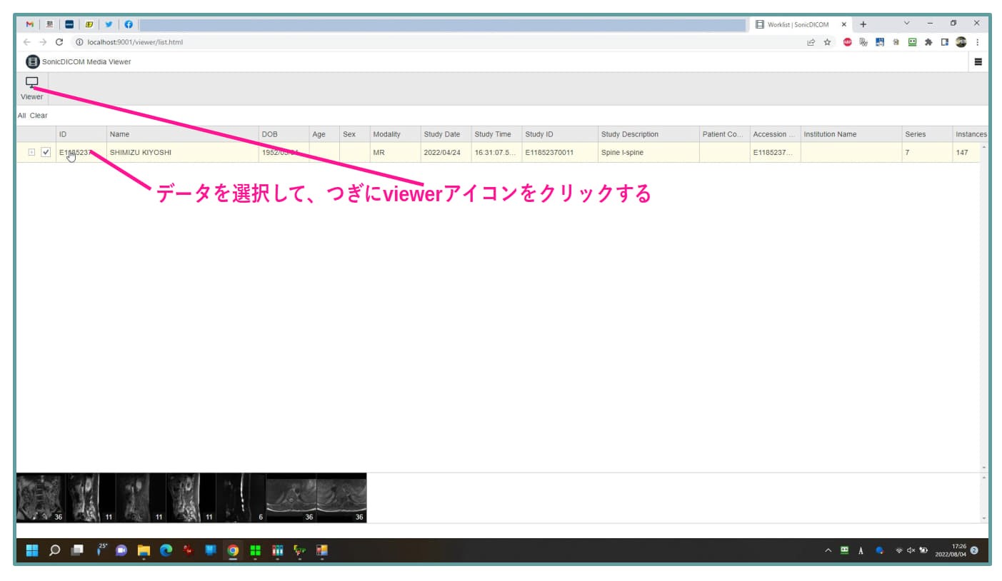 SonicDICOM procedure 3