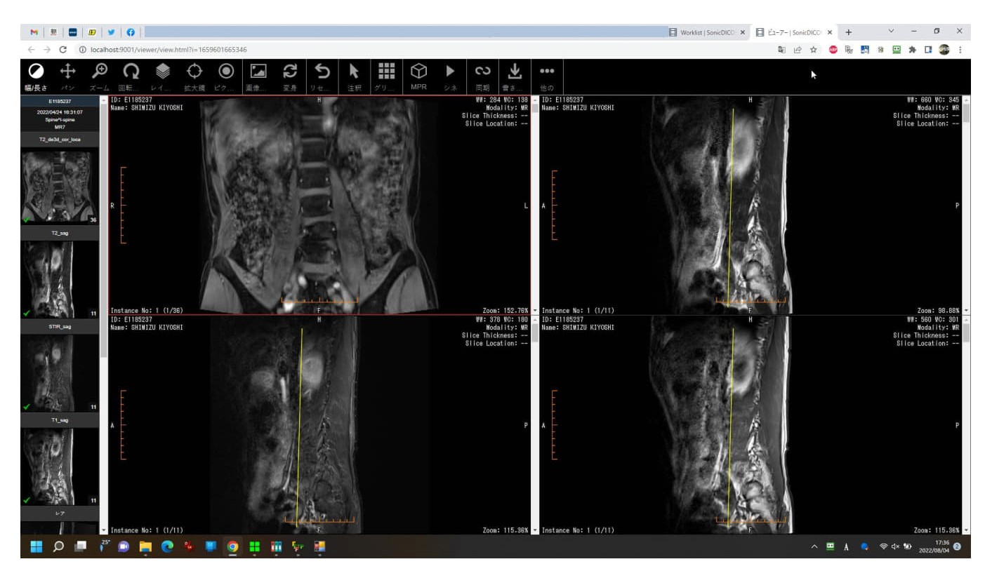 sonic DICOM procedure 4